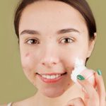 Macchie sul Viso: Migliori rimedi per eliminare macchioline dal viso (anche scure)