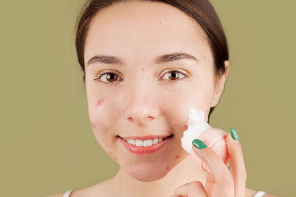 Macchie sul Viso: Migliori rimedi per eliminare macchioline dal viso (anche scure)